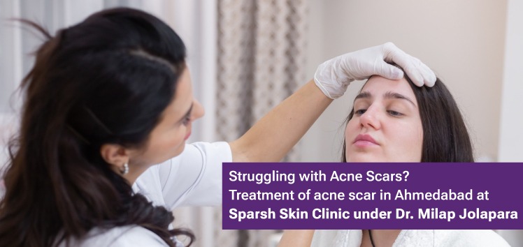 acne scars and pores treatment
