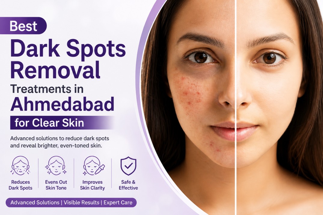 skin specialist in ahmedabad